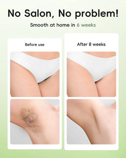 At Home Epilatotr Laser Hair Removal Appliance